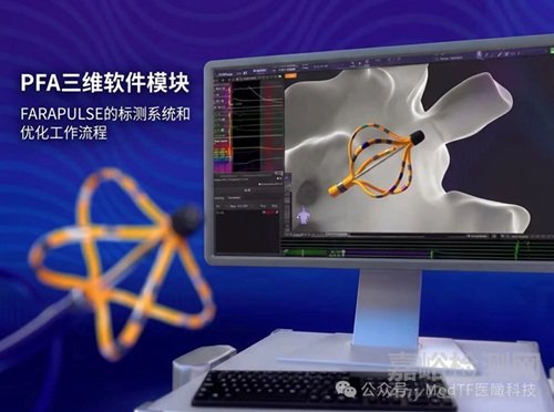 波士頓科學(xué)全球首創(chuàng)PFA三維標(biāo)測(cè)系統(tǒng)獲批NMPA