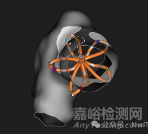 波士頓科學(xué)全球首創(chuàng)PFA三維標(biāo)測(cè)系統(tǒng)獲批NMPA