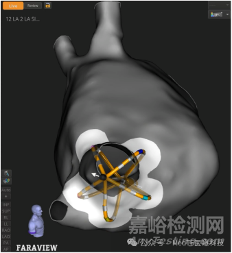 波士頓科學(xué)全球首創(chuàng)PFA三維標(biāo)測(cè)系統(tǒng)獲批NMPA
